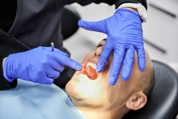 Best Emergency Dentist for Knocked-Out Tooth in Taylorsville, KY